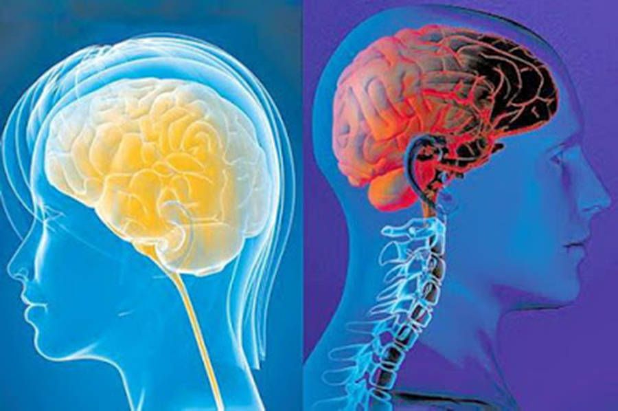 Hormona presente en la maternidad protege al cerebro