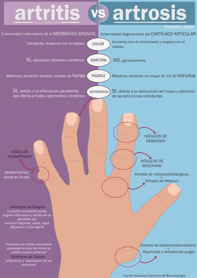 Conoce las principales causas de la artritis y la artrosis